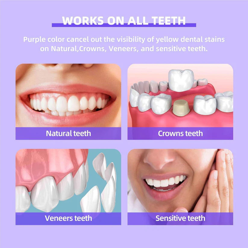 Teeth Whitening Paste Ultra SP-4