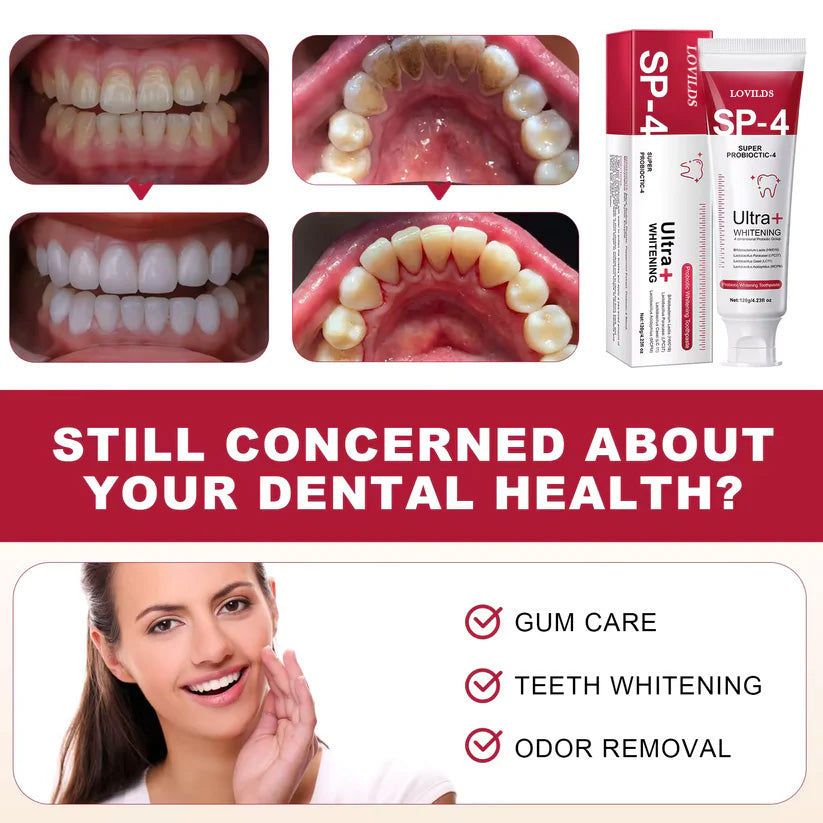 Teeth Whitening Paste Ultra SP-4