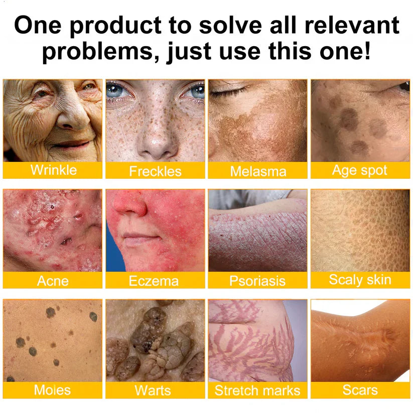 ✨✨✨FDA Approved: NESLEMY® Bee venom Pro Comprehensive Cream — 🔥Limited Time 80% OFF🔥