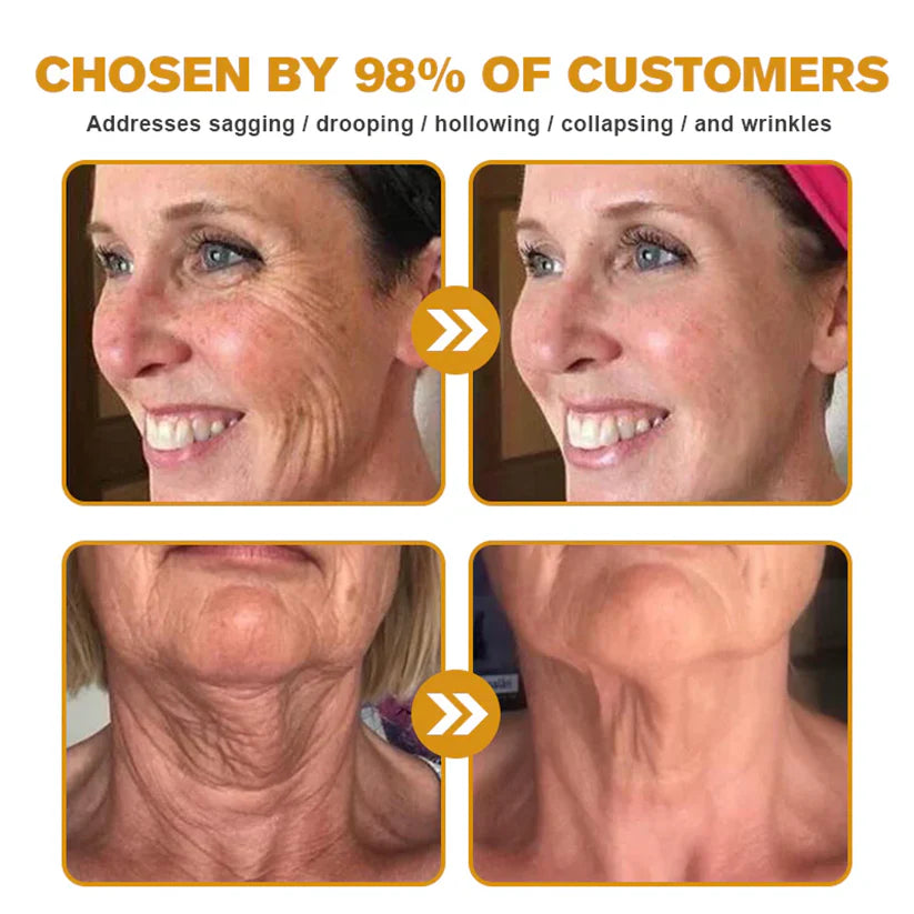 ✨✨✨FDA Approved: NESLEMY® Bee venom Pro Comprehensive Cream — 🔥Limited Time 80% OFF🔥
