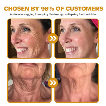 ✨✨✨FDA Approved: NESLEMY® Bee venom Pro Comprehensive Cream — 🔥Limited Time 80% OFF🔥
