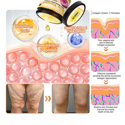 ✨✨✨FDA Approved: NESLEMY® Bee venom Pro Comprehensive Cream — 🔥Limited Time 80% OFF🔥
