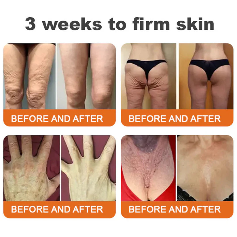 ✨✨✨FDA Approved: NESLEMY® Bee venom Pro Comprehensive Cream — 🔥Limited Time 80% OFF🔥