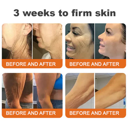 ✨✨✨FDA Approved: NESLEMY® Bee venom Pro Comprehensive Cream — 🔥Limited Time 80% OFF🔥