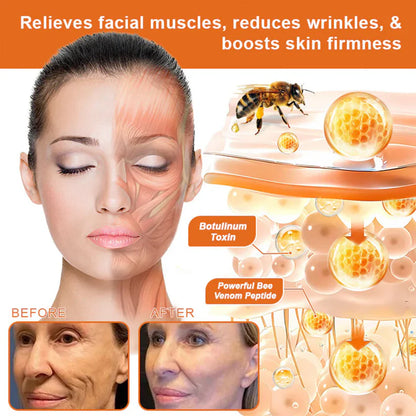 ✨✨✨FDA Approved: NESLEMY® Bee venom Pro Comprehensive Cream — 🔥Limited Time 80% OFF🔥